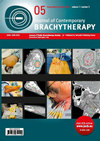 Journal Of Contemporary Brachytherapy